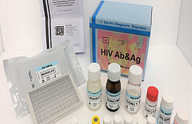 HIV Ab&Ag – ELISA