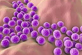 Staphylococcus aureus subsp. aureus derived from ATCC® 25923™