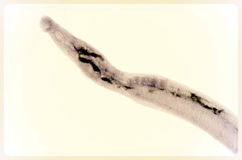 Schistosoma Antibody Assay