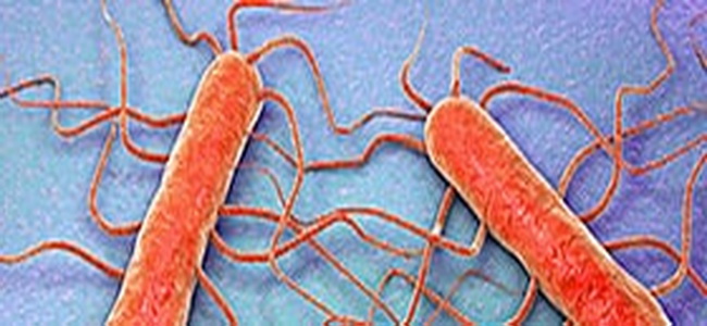 Listeria monocytogenes & Listeria spp.